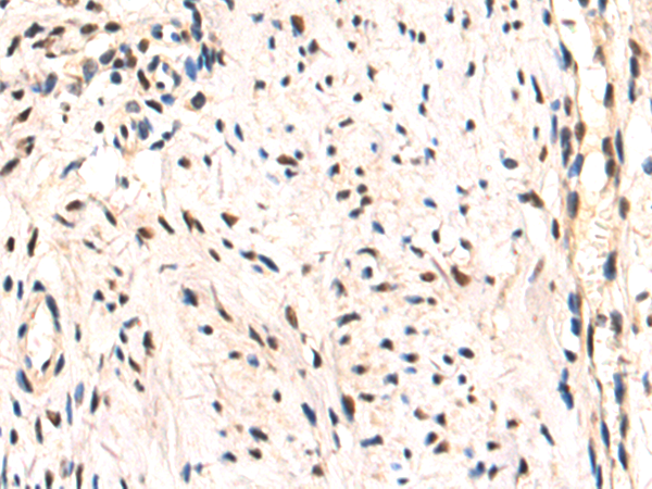 Fto Anti Fto Rabbit Polyclonal Antibody