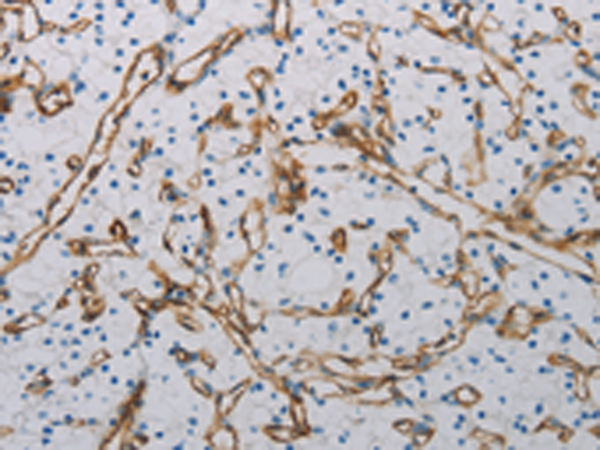 兔抗PECAM1多克隆抗体 Anti PECAM1 rabbit polyclonal antibody 生命科学产品与技术服务 生工生物工程