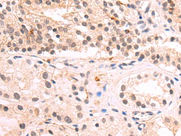 兔抗PMS2多克隆抗体 Anti PMS2 rabbit polyclonal antibody 生命科学产品与技术服务 生工生物工程 上海