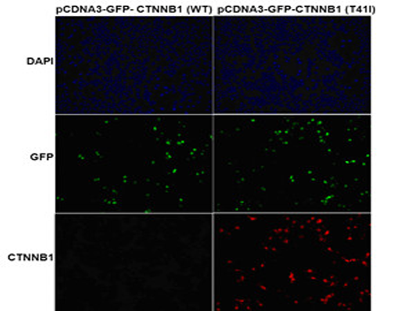 Ctnnb Mutated T I Anti Ctnnb Mutated T I Mouse