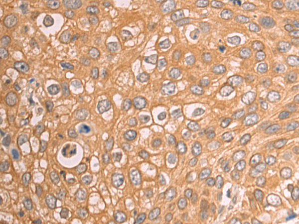 Btg Anti Btg Rabbit Polyclonal Antibody