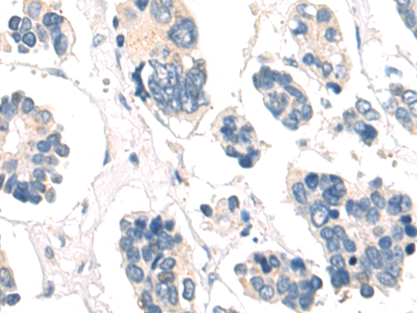 兔抗SIRT3多克隆抗体 Anti SIRT3 rabbit polyclonal antibody 生命科学产品与技术服务 生工生物工程