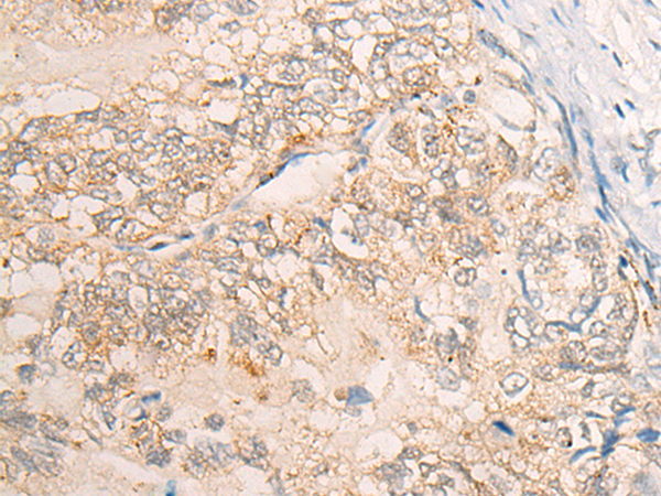 Vps Anti Vps Rabbit Polyclonal Antibody