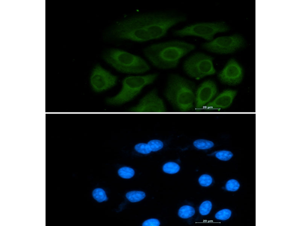 兔抗ACLY单克隆抗体 Anti ACLY rabbit monoclonal antibody 生命科学产品与技术服务 生工生物工程 上海