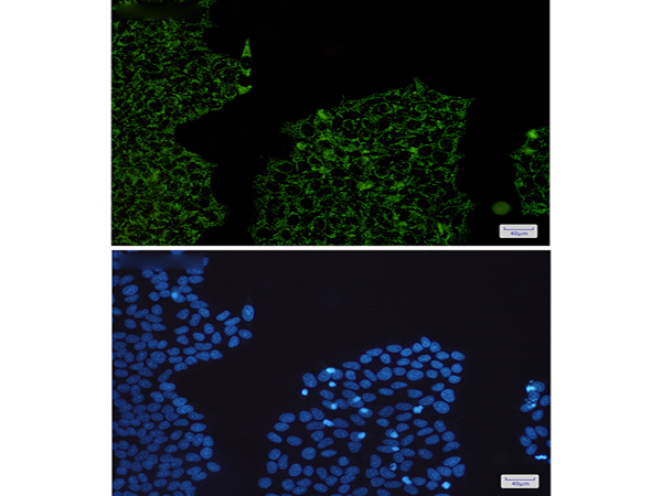 兔抗HADHA单克隆抗体 Anti HADHA rabbit monoclonal antibody 生命科学产品与技术服务 生工生物工程