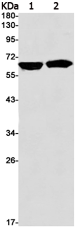 兔抗IGF2BP1单克隆抗体 Anti IGF2BP1 rabbit monoclonal antibody 生命科学产品与技术服务 生工生物