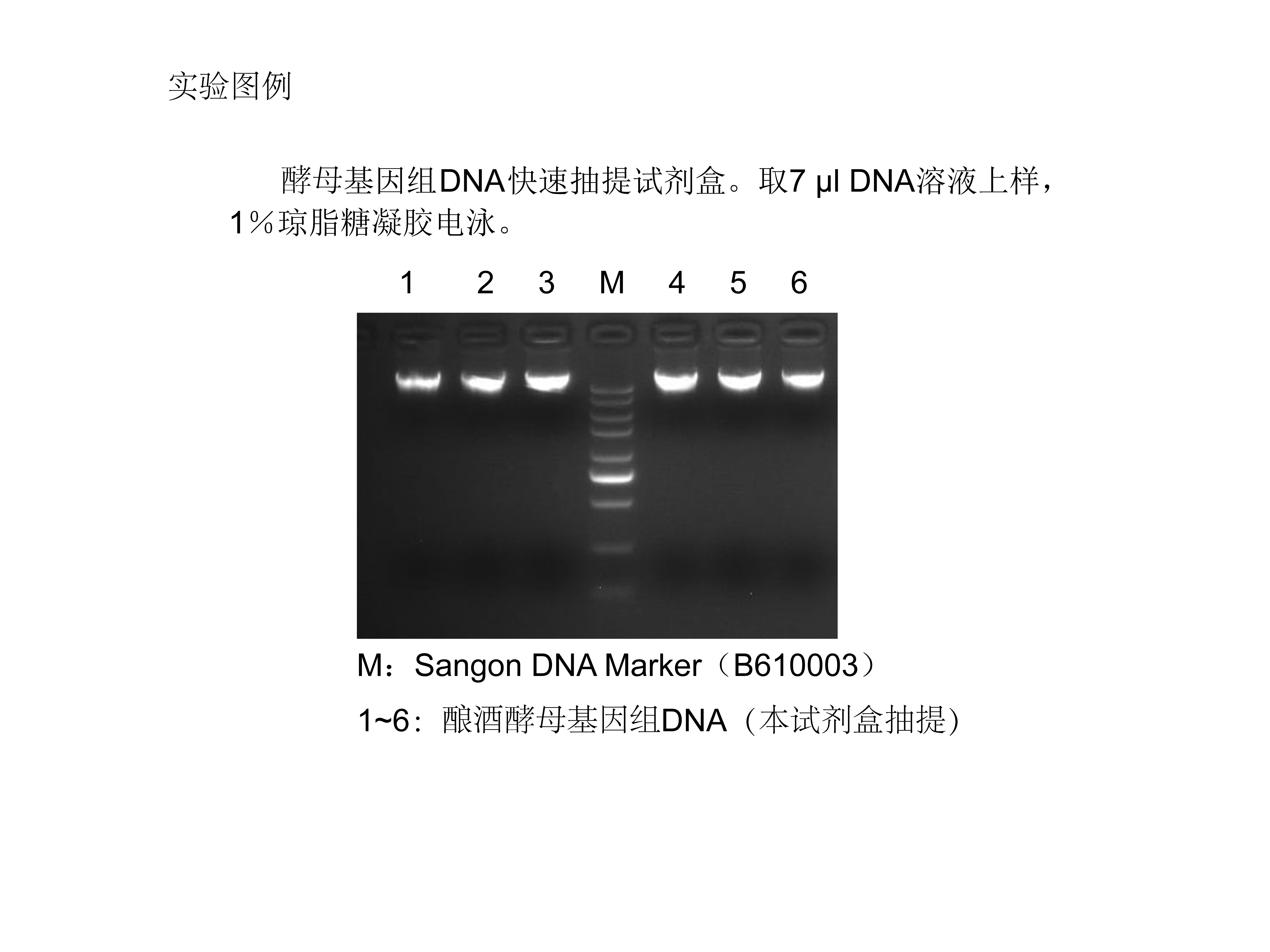 Ezup Dna Ezup Column Yeast Genomic Dna Purification Kit