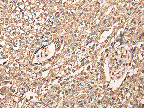 兔抗ATF7多克隆抗体,Anti-ATF7 rabbit polyclonal antibody 生命科学产品与技术服务-生工生物工程(上海 ...