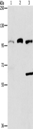 兔抗ASCC2多克隆抗体,Anti-ASCC2 rabbit polyclonal antibody 生命科学产品与技术服务-生工生物工程 ...