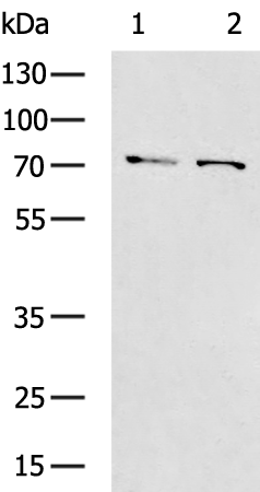 兔抗F2多克隆抗体,Anti-F2 rabbit polyclonal antibody 生命科学产品与技术服务-生工生物工程(上海)股份有限公司