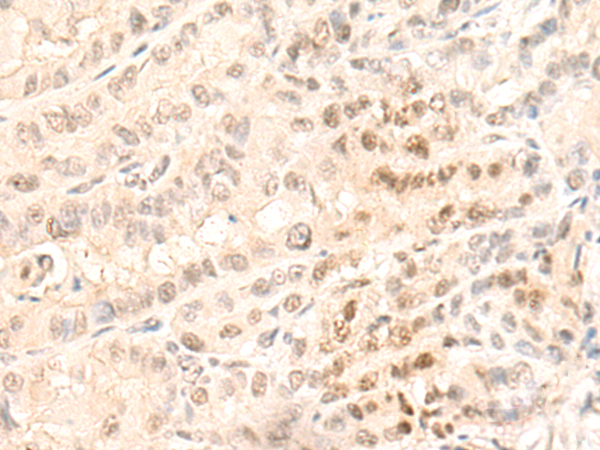 兔抗GTF2F1多克隆抗体,AntiGTF2F1 rabbit polyclonal antibody 生命科学产品与技术服务生工生物工程