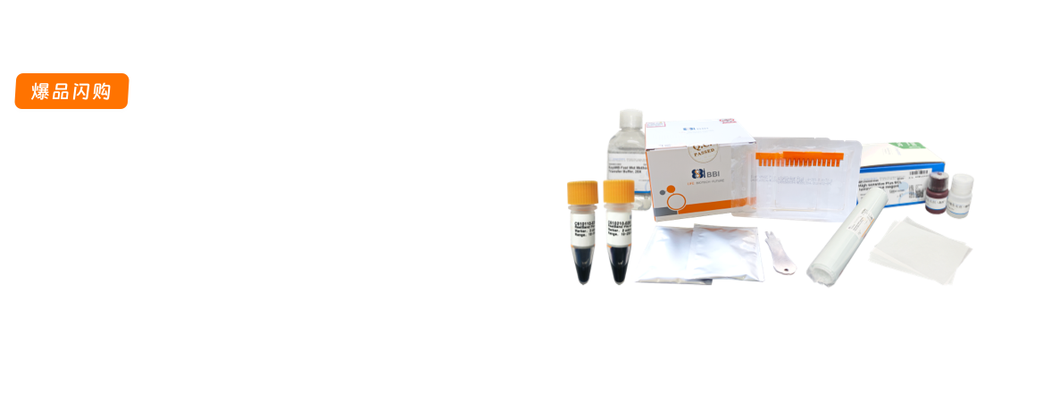 爆品促销之蛋白电泳&WB专题